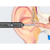 WiFi-kaameraga kõrvaotoskoop kõrvade puhastamiseks, komplekt 27506